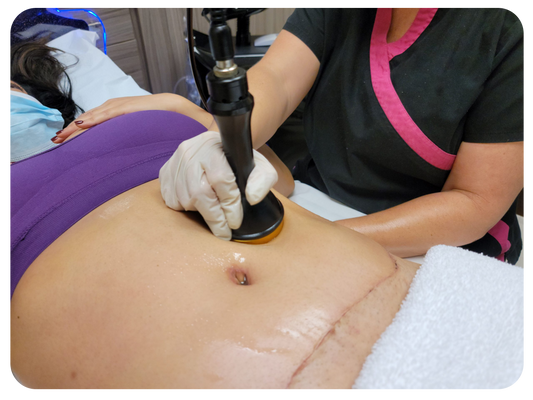 Ultrasonic Cavitation After Liposuction😁