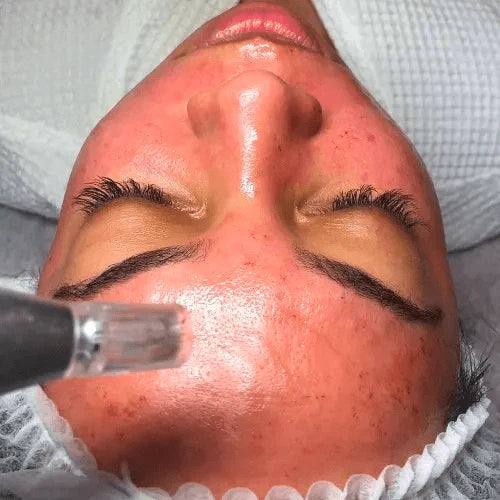 Special Treatments